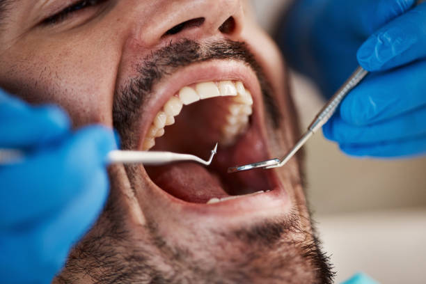 Best Tooth Extraction  in Sand Lake, MI